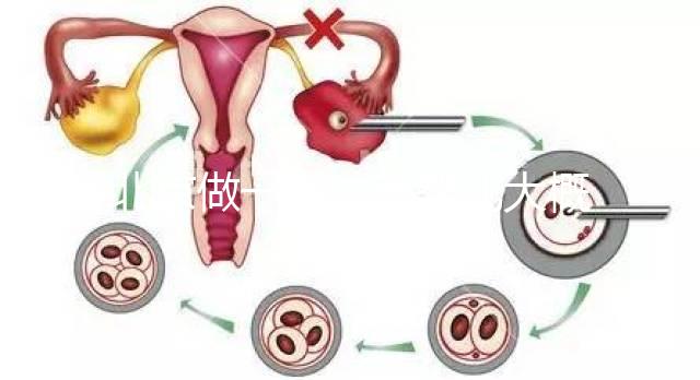 北京做一次試管嬰兒大概花多少錢？2025年價(jià)格及明細(xì)清單一覽！