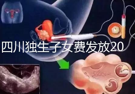 四川獨(dú)生子女費(fèi)發(fā)放2024年新規(guī)定,如何盡快領(lǐng)取自貢?