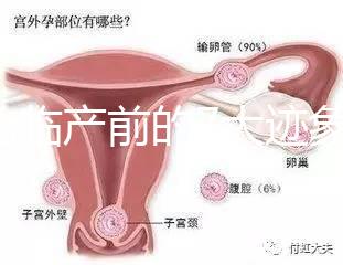 二胎臨產(chǎn)前的7大跡象,出現(xiàn)見紅、陣痛別大意