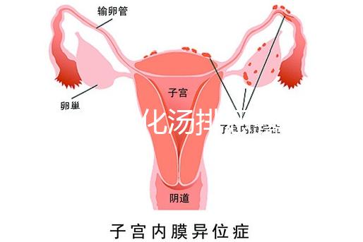 產(chǎn)后喝生化湯排惡露會(huì)使寶寶拉肚子？醫(yī)生：時(shí)間沒(méi)用對(duì)