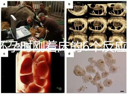 懷孕時剛著床的6個反應，同房后這個時候觀察身體最準