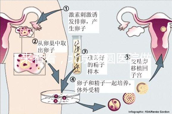 來(lái)看看,北京家圓醫(yī)院做三代試管費(fèi)用總共多少?