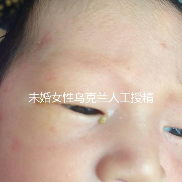 未婚女性烏克蘭人工授精必看！醫(yī)療及生活費用明細預(yù)覽