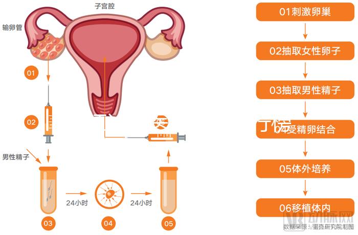 湛江試管醫(yī)院前十排行榜,久和醫(yī)院vs廣醫(yī)附院誰好一覽了然