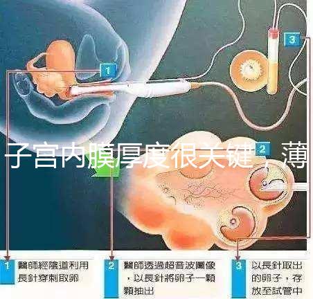 子宮內膜厚度很關鍵，薄了厚了試管嬰兒都難成功