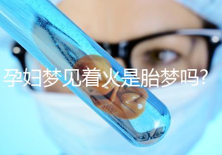孕婦夢(mèng)見著火是胎夢(mèng)嗎?不同夢(mèng)境意思介紹