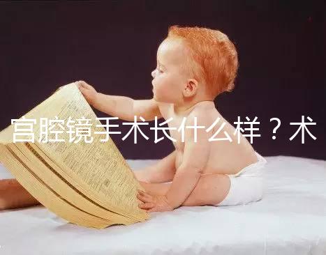 宮腔鏡手術長什么樣？術后要注意什么？ ?