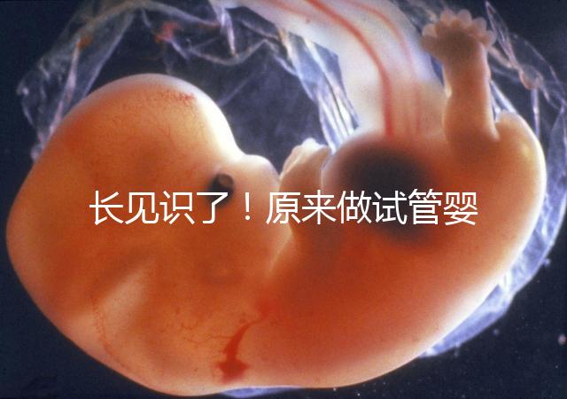 長見識了！原來做試管嬰兒，精子是這樣被篩選出來的