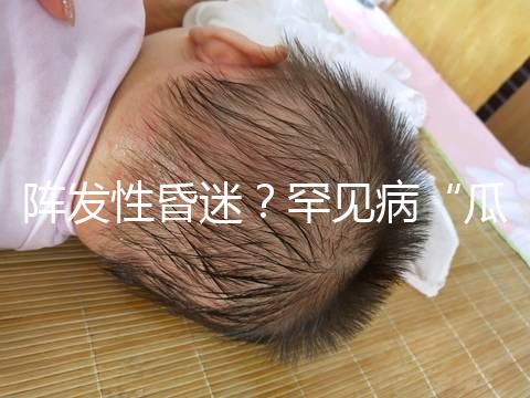 陣發(fā)性昏迷?罕見病“瓜氨酸血癥”請(qǐng)了解下!