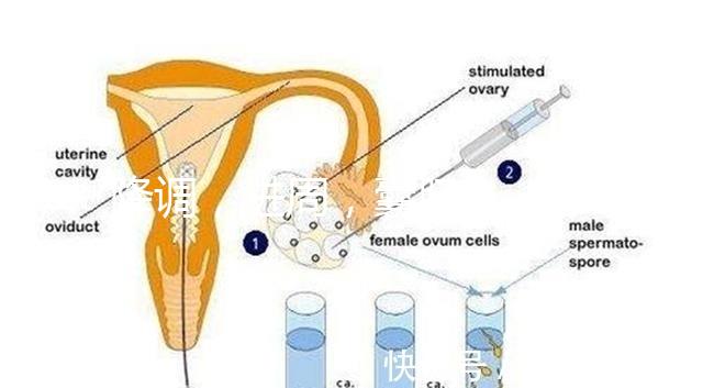 降調，進周，囊胚……這些試管嬰兒助孕術語你都懂嗎？