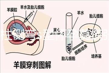 脊柱側彎s型懷孕莫慌張，能否順產還得看這4大要素