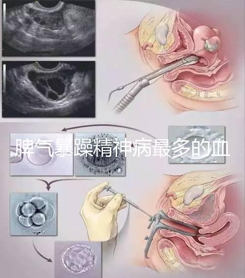 脾氣暴躁精神病最多的血型竟是…，4大血型隱藏了不同疾病