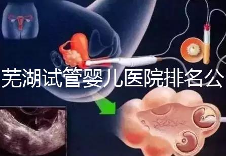 蕪湖試管嬰兒醫院排名公開，弋磯山醫院、蕪湖二院獲好評