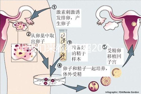 讓我們來看看b超20個卵子取10個是不正常的我們該怎么辦?