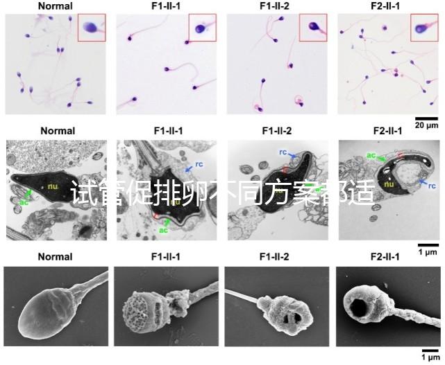 試管促排卵不同方案都適合哪些人?如何監(jiān)測(cè)排卵?