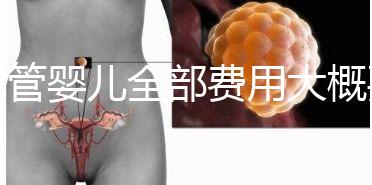 試管嬰兒全部費(fèi)用大概要多少錢？