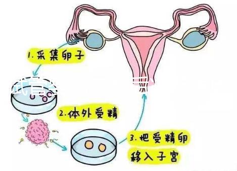 試管嬰兒二超后減藥原因已找到,對胎兒沒影響別瞎擔心