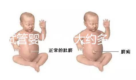 試管嬰兒費用大約多少2021年：國內試管之（10）額外可能需要費用：