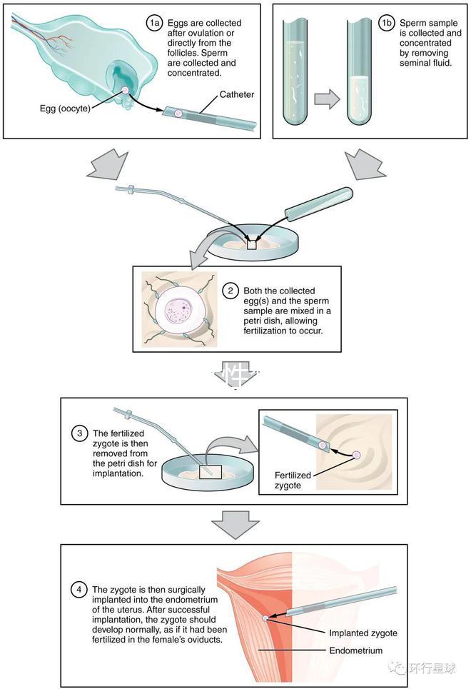 貴陽單身女性禁止凍卵？持“三證”已婚女性就能凍卵