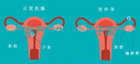 高齡產婦生八個孩子國家有補助？有沒有違法才是關鍵