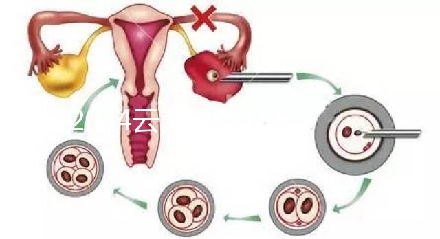 2024云南產假158天怎么算？新政策中，男方培育假貨