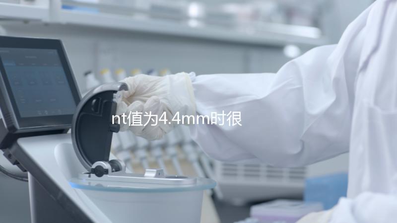 nt值為4.4mm時很危險(xiǎn),及時羊穿確認(rèn)胎兒畸形很重要