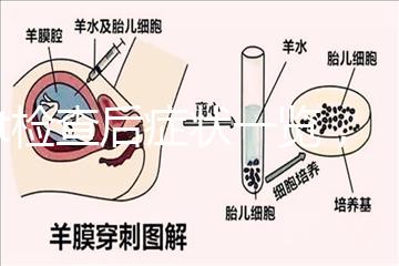 tct檢查后癥狀一覽，專家提醒做好處理措施是關鍵